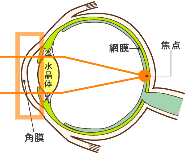 昼:レンズをはずした後