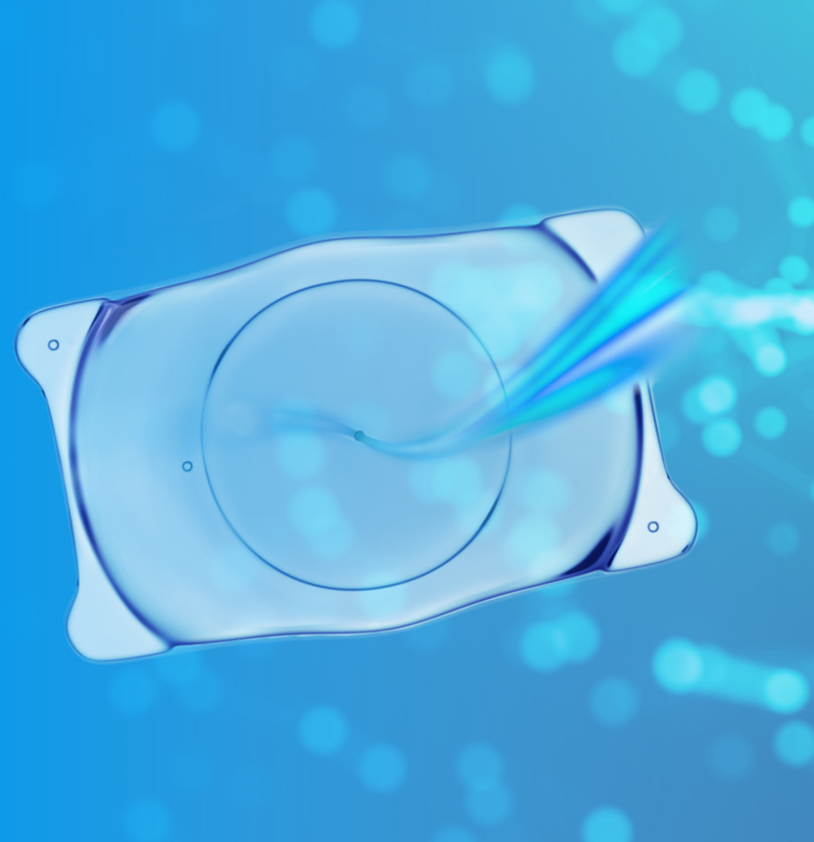 ICL手術について